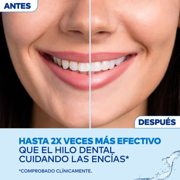 Irrigador bucal Waterpik® hasta 2X veces más efectivo que el hilo dental