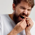 Gingivitis