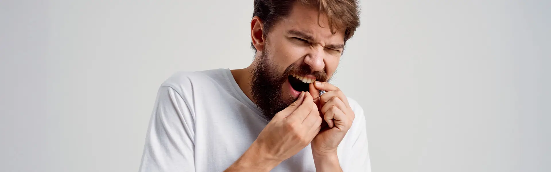 Gingivitis