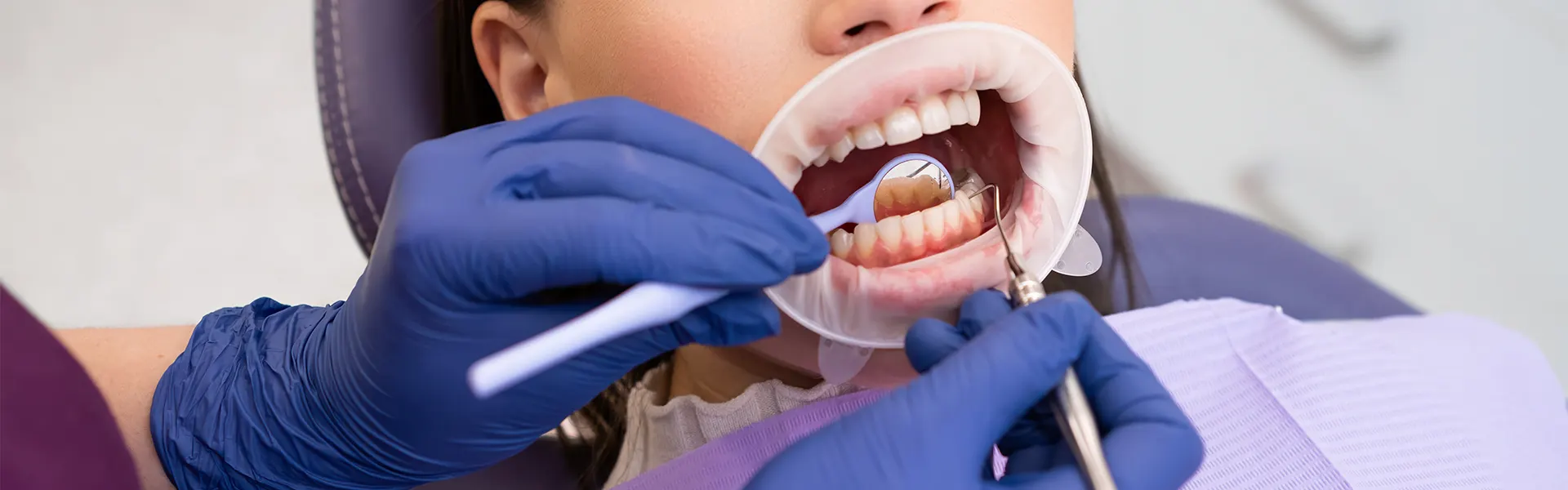 Cómo Eliminar Sarro Y Placa Dental De Forma Efectiva Waterpik
