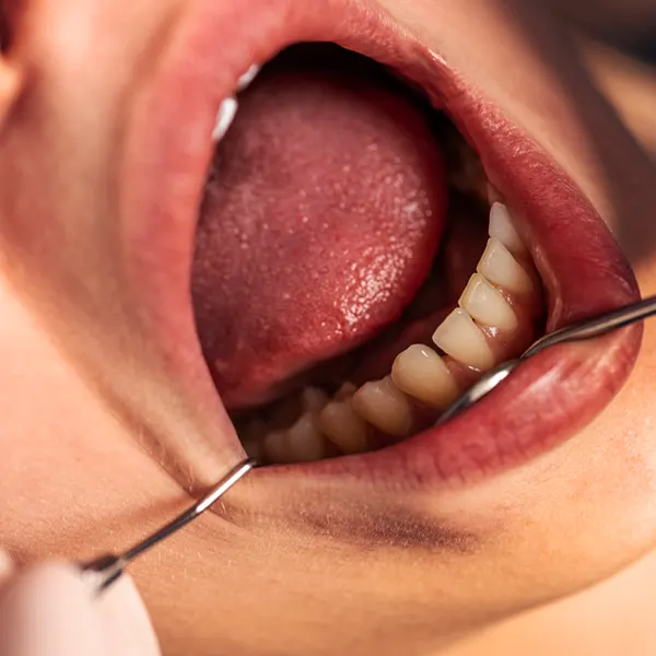 Odontologo examinando dentadura de un paciente