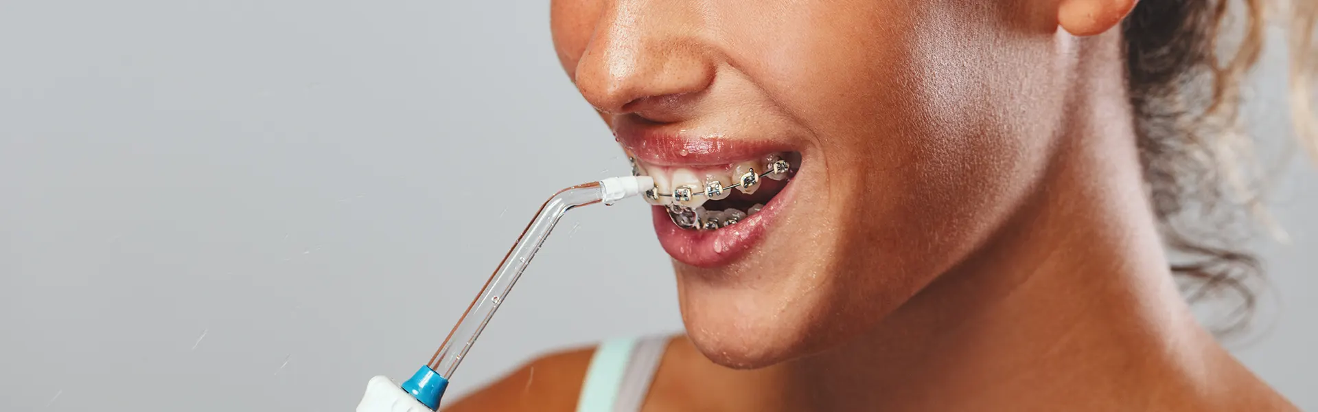 ¿Cómo limpiar tus brackets con un irrigador dental? Guía fácil